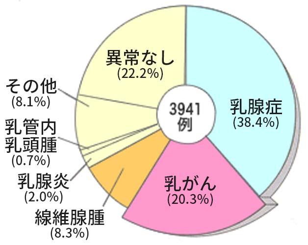 乳腺の病気